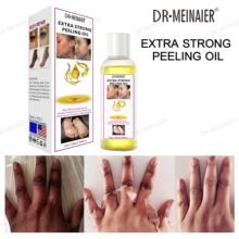 Peeling Oil�羳ÓƤ��ȥ���|�͵������c���w�ֲ��沿���w�o����