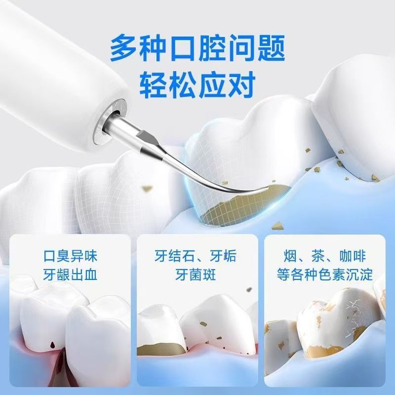 【工厂跨境】超声波洁牙器洗牙器牙结石牙垢去除器电动牙齿清洁仪|undefined