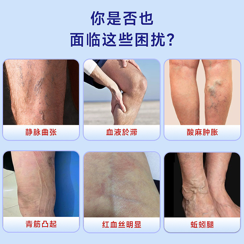 静脈瘤タイプ医療解熱冷湿布ジェル公式本物の足の腫れ鎮痛補助治療|undefined