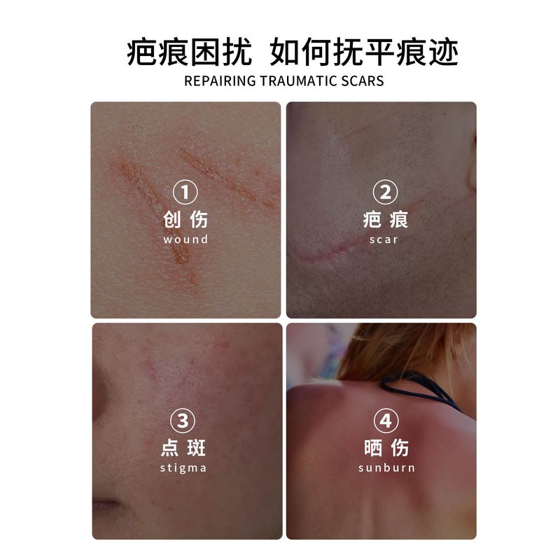 美容院专用修复肽点痣点斑烫烧伤破皮术后修护精华液院线小样批发|undefined