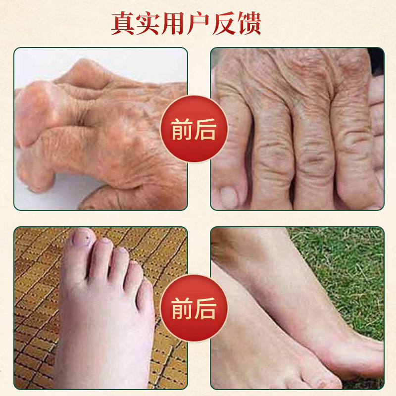加藤久野鎮痛軟膏 指腱鞘結晶腫れ軟膏 首肩痛 指つま先痛 風湿軟膏|undefined