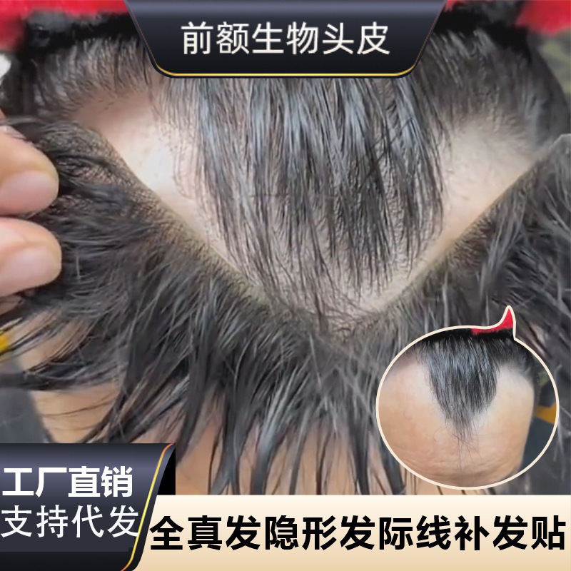 发际线假发贴假刘海假发片m形发际线贴男一片式前额补发自然真发|undefined