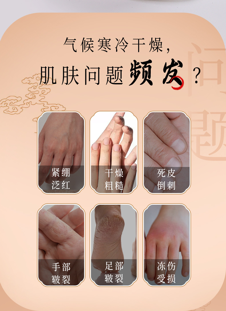 JINTAIKANG Astragalus Cracked Skin Care Cream Hand and Foot Moisturizing Herbal Balm 200g key features