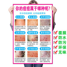青春痘产生的原因痘痘的类型痤疮美容医疗海报医院挂图宣传画有框