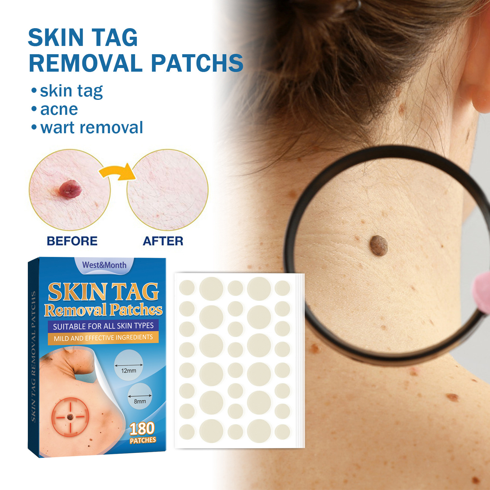 West Month wart patch meat grain wart removal flat skin repair patch you wart sharp wart wart plaster