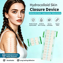 ���Q���ڜp����Wound Closure Strip�̺��o����p�z�����Ȱ�CE