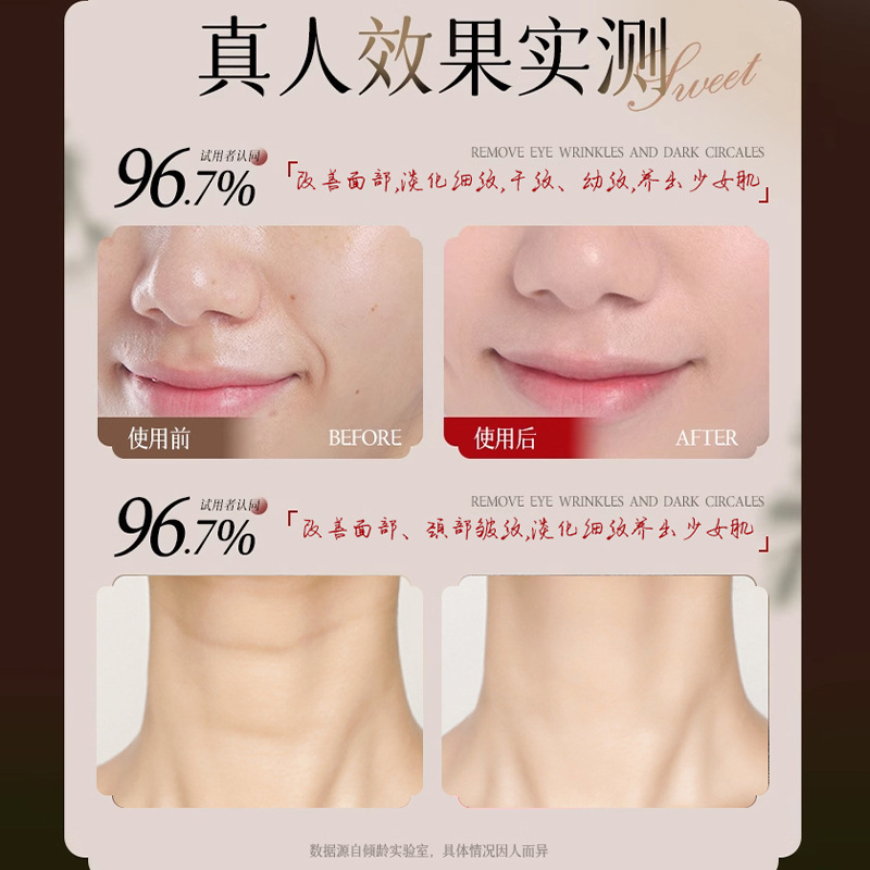 Extracto de ginseng antiarrugas de hierbas de Qingling, líneas ligeras, líneas de cola de mergullo, líneas suaves y nutritivas