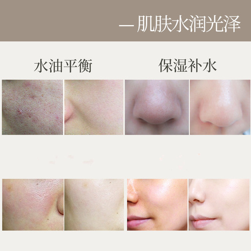 Meikang Fendai herbal aloe vera gel 80g men and women hydrating moisturizing skin care cream hydrating gel cream non-sticky