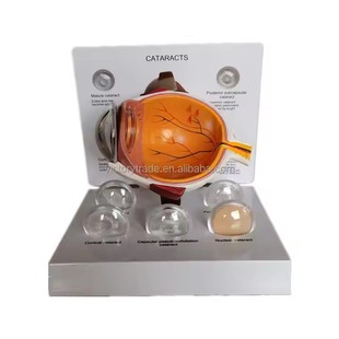 Replaceable Eye Crystal Eye Model White Intraocular Lens Model Eyeball Anatomy Eye Disease Eyeball Lesion