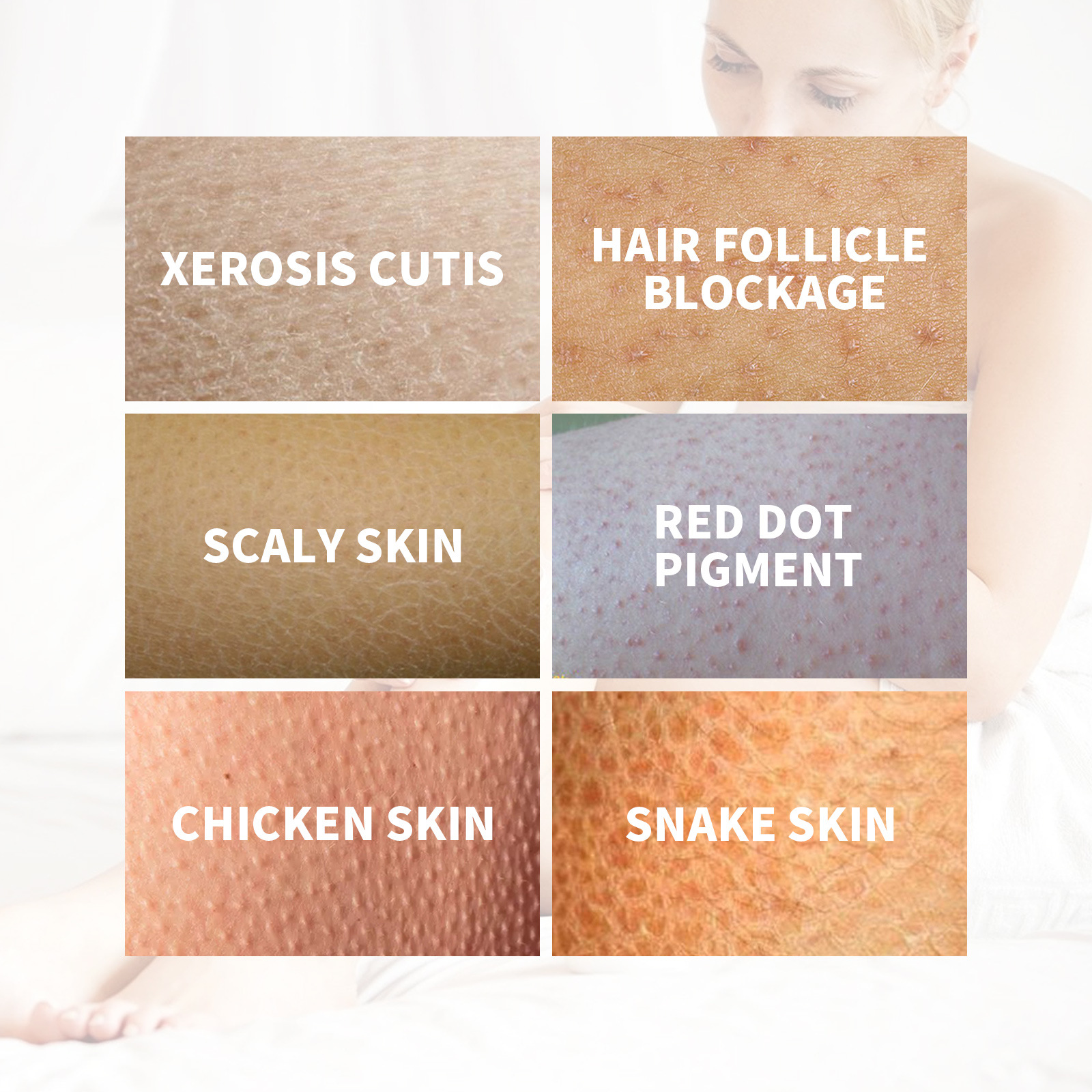 Crema riparatrice per la pelle di pollo South Moon con peeling intorno ai capelli e al corpo_voghion.com