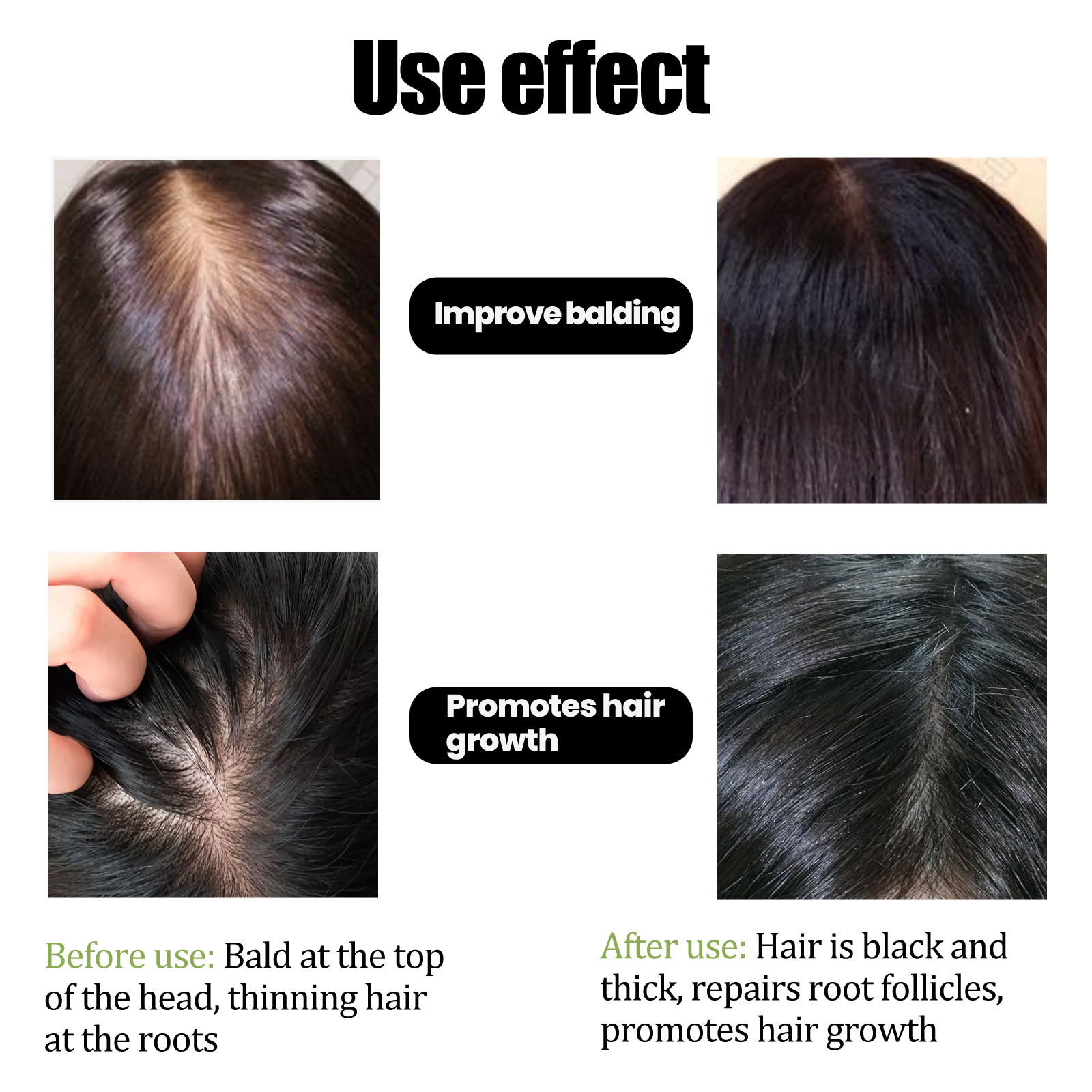 EELHOE Dense Oil Thickens Firms Hair, Nourishing Repairing Roots, Caring for Strong and Tough Hair_voghion.com