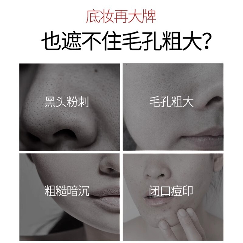 エステサロン専用黒ずみ除去液、エステサロン専用洗浄水、毛穴閉鎖ニキビエッセンス、縮小液|undefined