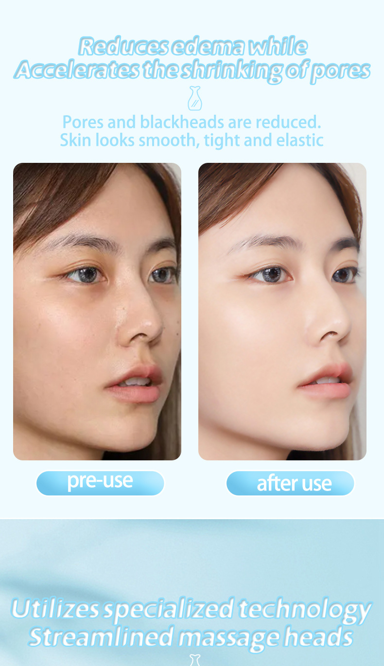 Cooling Facial Massager 5