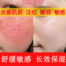 积雪草原液修护原液祛痘印修复激素脸泛舒缓敏感肌甘草修护精华液