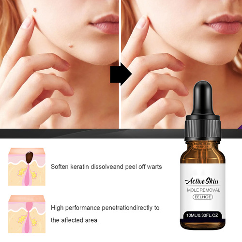 EELHOE Spot Mole and Wart Essence Skin, Face, Armpits, Neck Removal, Repair, Cleansing and Care