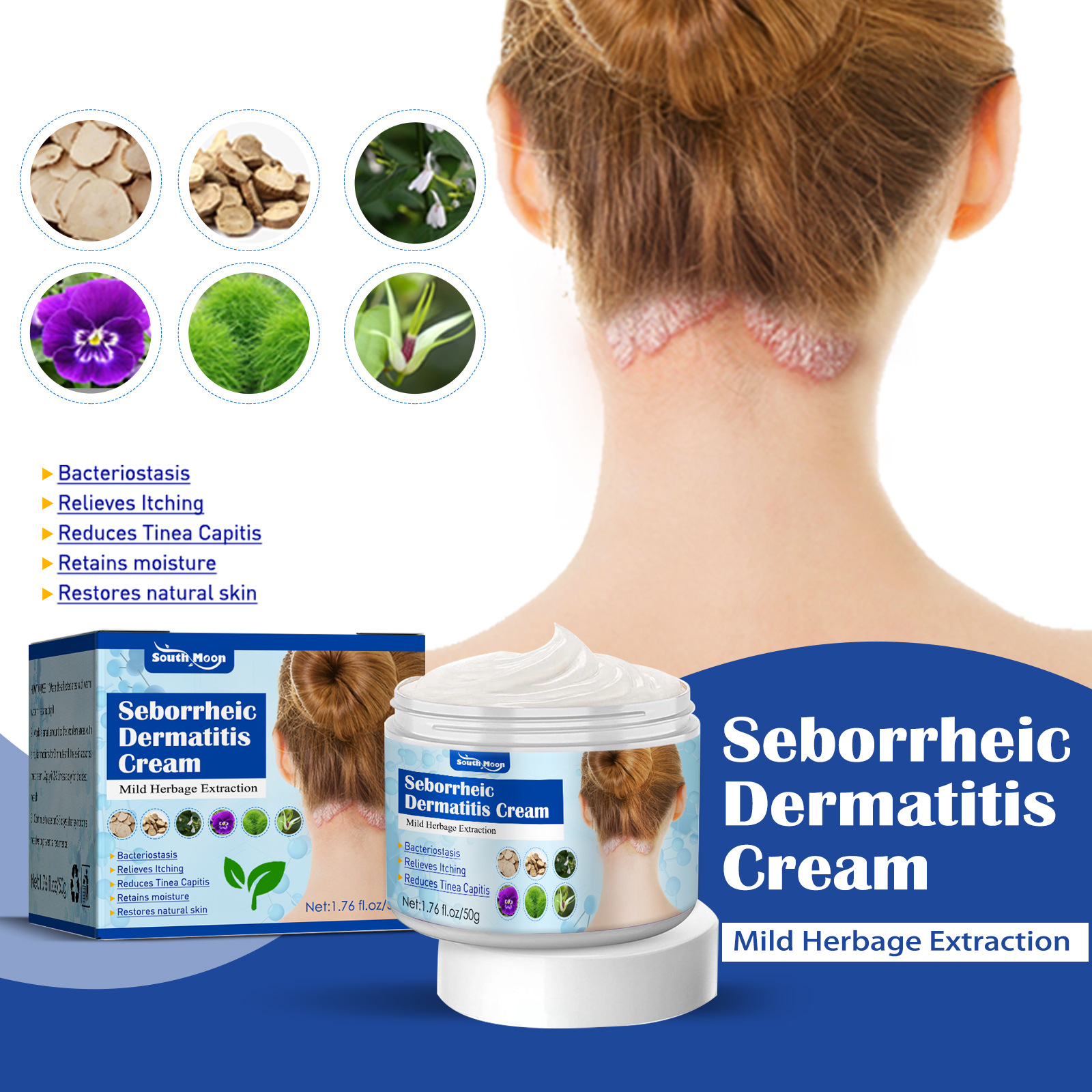South moon seborrheic skin cream head acne itching scalp ringworm skin problem repair skin cream_voghion.com