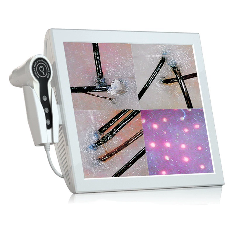 15inch четырехсекционный детектор кожи головы HD «все в одном», интеллектуальный анализатор волосяной фолликулы, детектор кожи