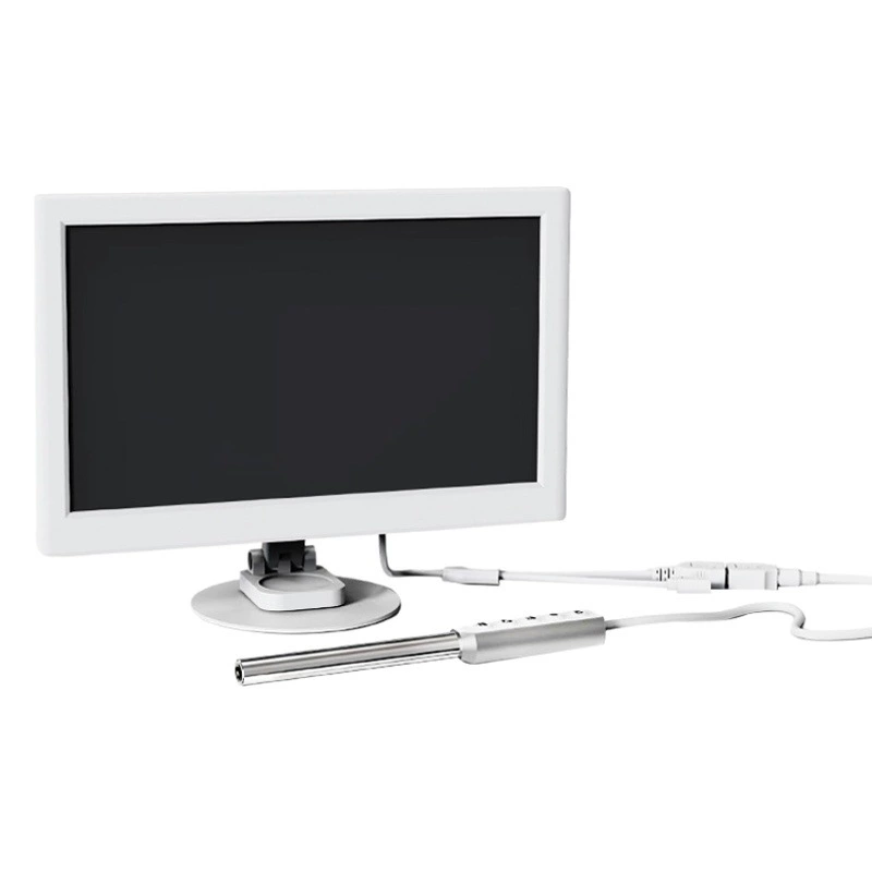 Вагинальный эндоскоп гинекологический, интимный, для женщин, с высококачественной электронной камерой и функцией фотосъемки, инструмент для осмотра, для салонов красоты, широкоугольный