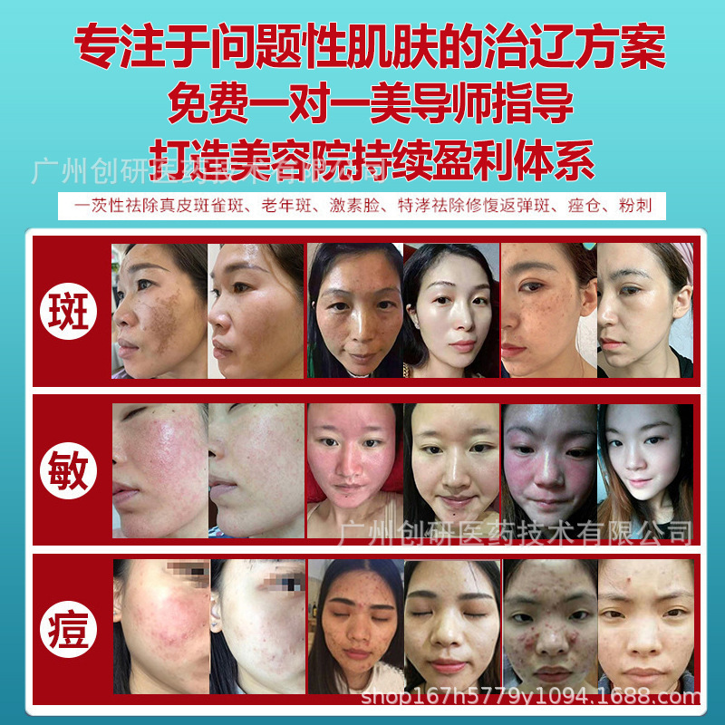 修復氷晶緩和クリーム赤表皮因子冷敷ゲル術後敏感修復ジェル美容院専用|undefined