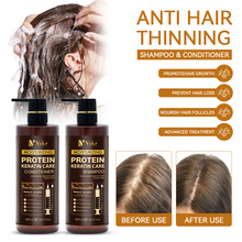 Ӣ�����Q�羳����Needle tube protein keratin�o�l��ϴ�lˮ�lĤ