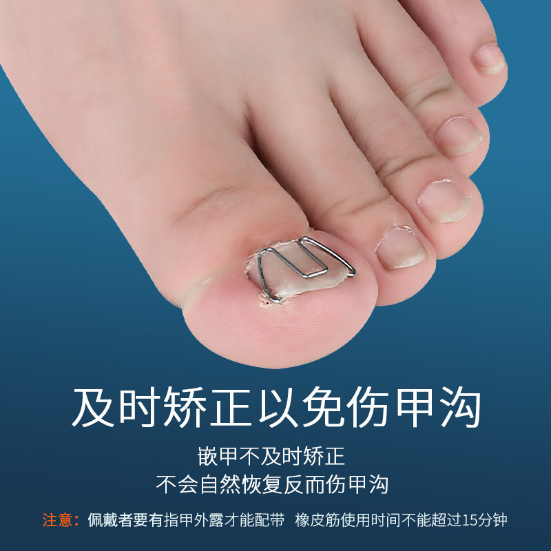 Ingrown Toenail Correction Tool for Correcting Ingrown Nails, Nail Groove Correction, Ingrown Toenail Correction, Toenail Correction Device, Pedicure Tool