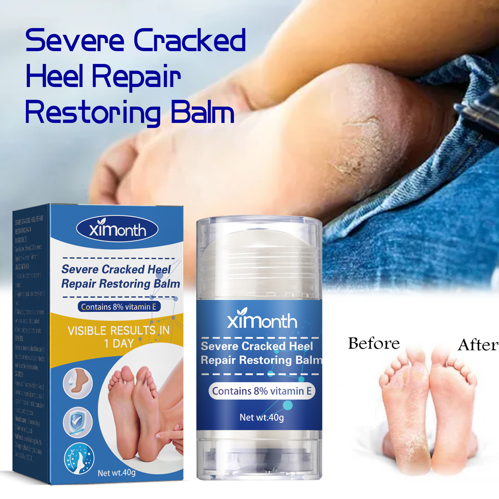 Ximonth腳跟修護霜 防腳後跟皴裂起皮修護乾燥裂紋保濕保潤足部