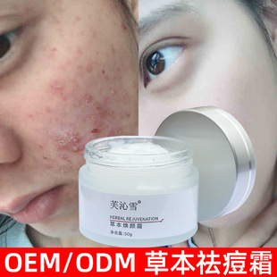 �ݱ��˪ȥ�ഺ���۴̵������o���۶�ӡȥ����С�׺���˪���Ʒ