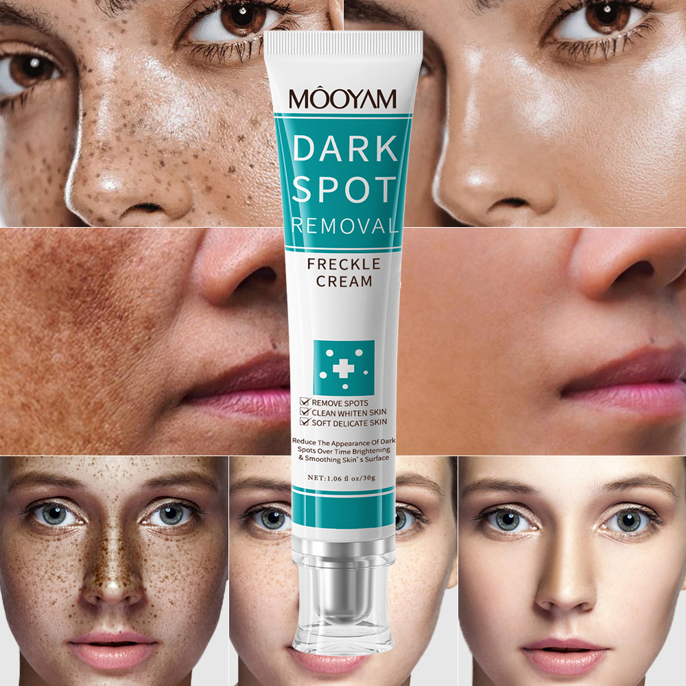 DARK SPOT REMOVAL CREAM 黑斑面霜 WHITENING FRECKLE CREAM