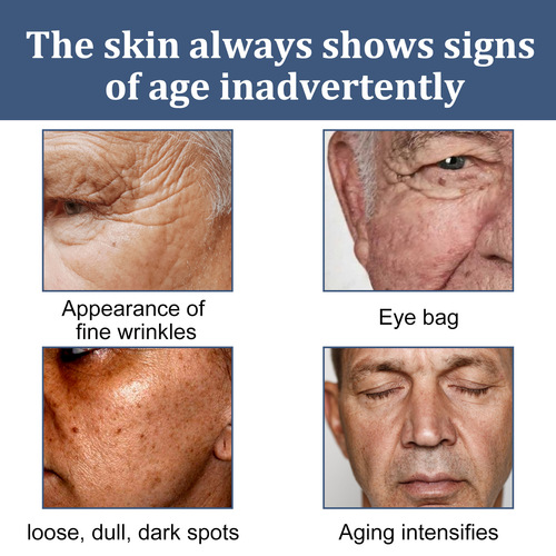 East Moon Men's Facial Moisturizing Cream Moisturizing and Reducing Fine Lines, Eye Bags and Dark Circles Facial Care Cream