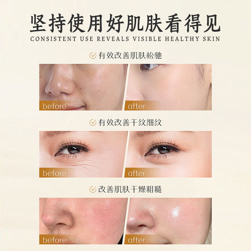 不挂网线下款院线面部护理套高端补水紧致滋养护肤套盒私域美容院|undefined
