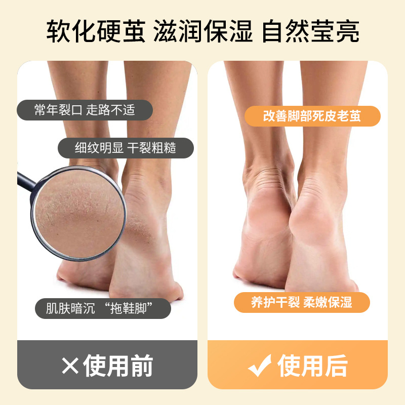 Moisturizing and Repairing Cream for Cracked Heels and Chapped Hands