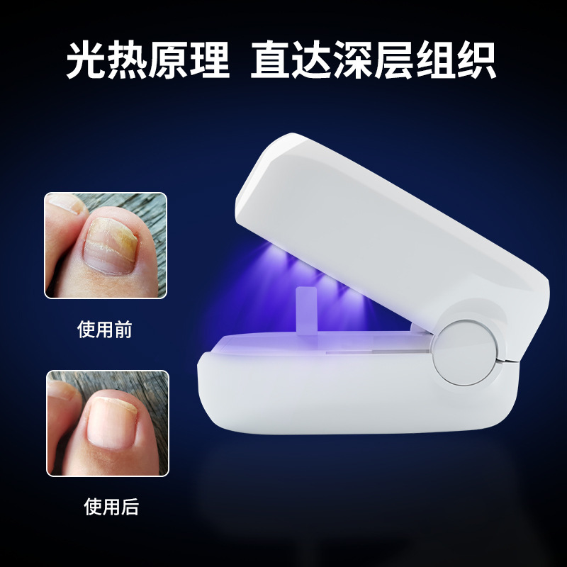 国境を越えた新しいポータブル補助ツール UV 爪真菌ランプ UV 爪真菌ミニ光線療法ランプ|undefined