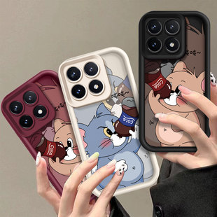 �m��С��17PRO�֙C���t��80PRO�ɘ���ķܛ�znote15��ͨȫ�����o��