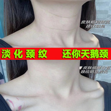 颈纹霜六胜肽淡化颈纹去颈神器美颈霜纹补水保湿提拉紧致颈膜批发