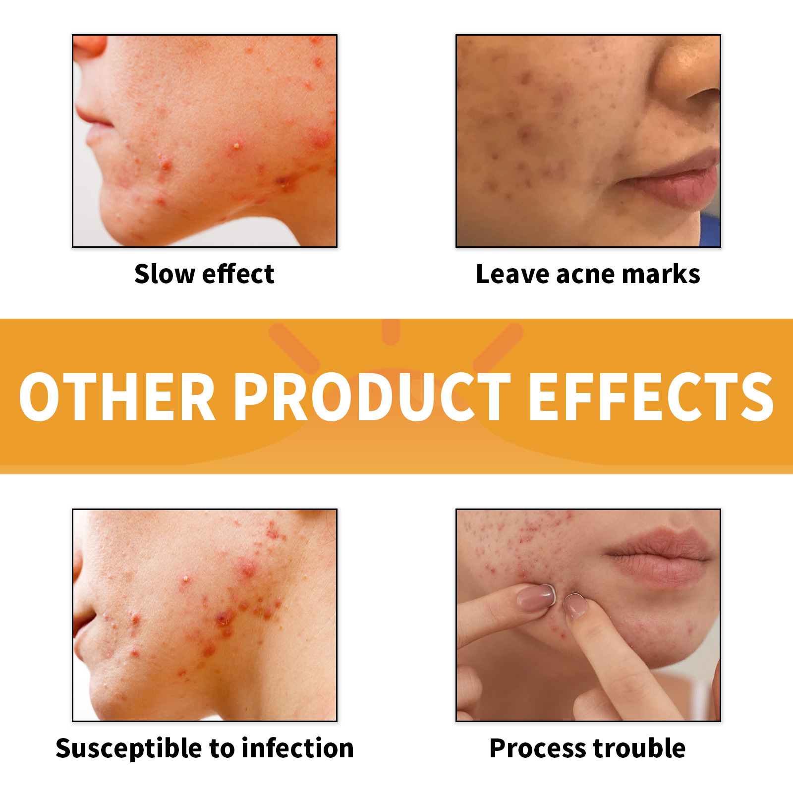 Jaysuing Chin Gel Patch de nettoyage portable pour enlever et imprimer l'acné_voghion.com