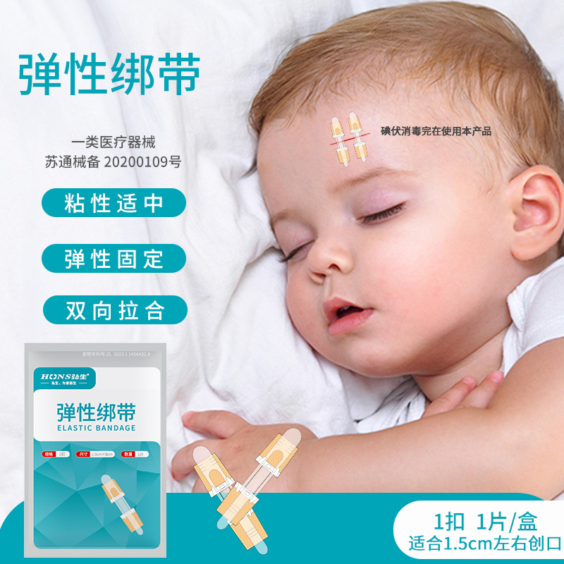 ホンシェン張力緩和器、縫合不要創傷閉鎖器、不織布ジッパー式創傷パッチ、皮膚張力緩和吻合器