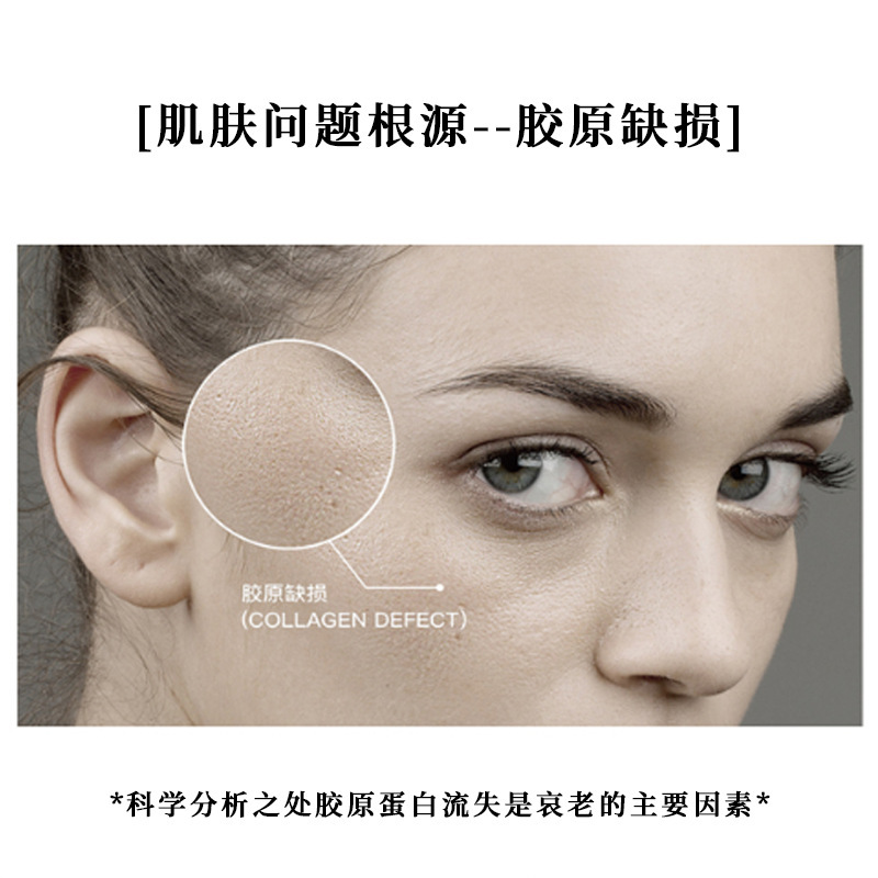 Weiyimei Beauty Salon は、コラーゲンをサポートし、充填し、刺激し、コラーゲンの再生を促進するタイプ 1 コラーゲンのカスタマイズに特化しています。|undefined