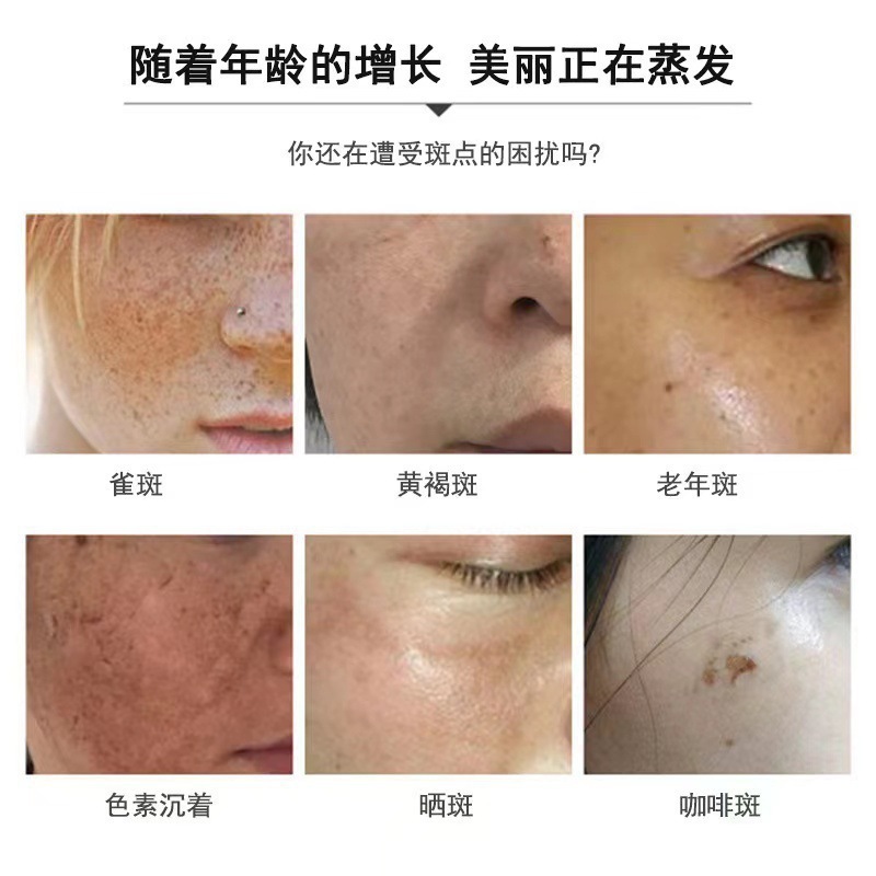 肌の色を明るくし、鉛、水銀、肝斑を除去する臭いのある水、黒色素を除去する液体、シミ液、エッセンス水|undefined