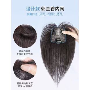 Tulip Wig for Women, Head Replacement, High Skull, Increased Hair Volume, Fluffy, Anti-Human Hair, Light and Traceless Wig