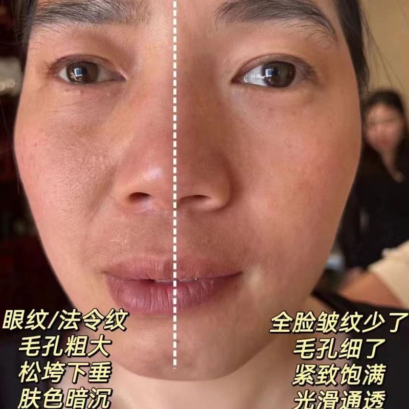女神マイクロ手術ドライマスクシルクプロテインバイオベース抗しわマスク引き締めクレンジング美白抗しわマジッククリスタルマスク|undefined