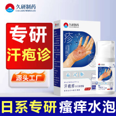 久研制药手上起小水泡孢疹汗状汗泡诊止痒真菌非感染汗泡诊膏湿诊