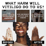 SUHU Крем, лечебная травяная мазь, Amazon, наружное применение, оптовые продажи