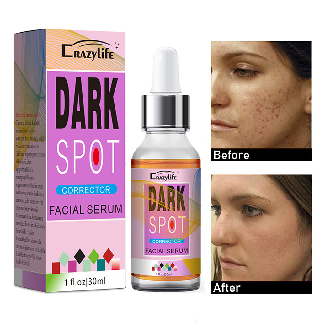 Siero viso anti-macchie per un colorito uniforme e luminoso_voghion.com