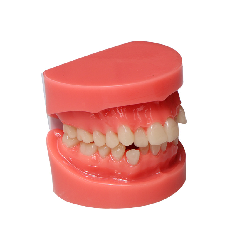 Modelo dental, modelo de corrección de demostración de mandíbula incorrecta, práctica de dentista, modelo de brackets pegajosos, molde de enseñanza de corrección