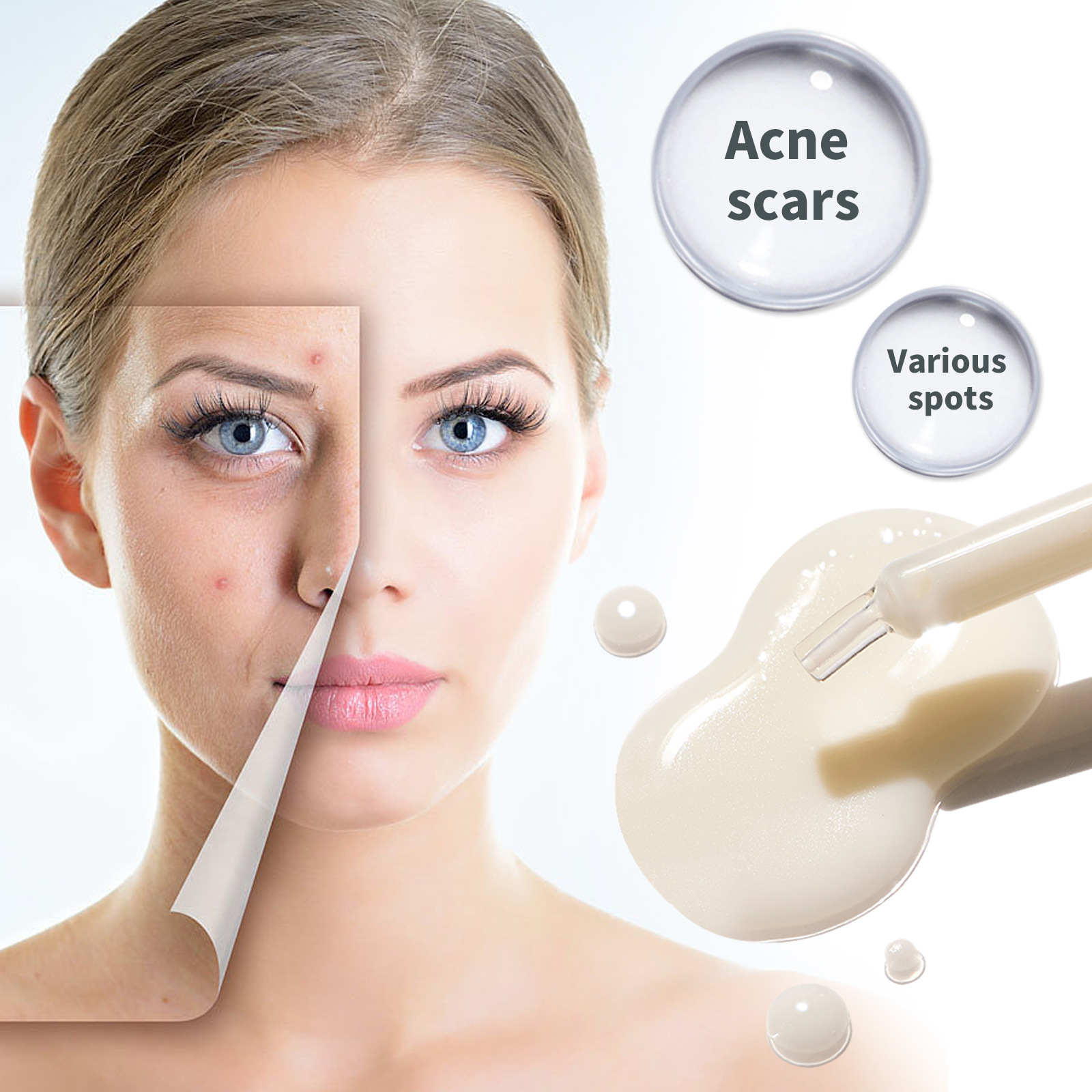 OUHOE Dark Spot&Acne för att bleka fläckar, återfukta huden, reparera aknemärken, mörka och ljusa upp ansiktets essens_voghion.com