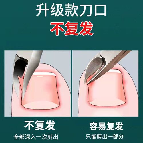 Stainless steel dead skin pliers, nail groove scissors, special toenail scissors, nail clippers, ingrown toenail clippers, hawkbill nail clippers, pedicure set
