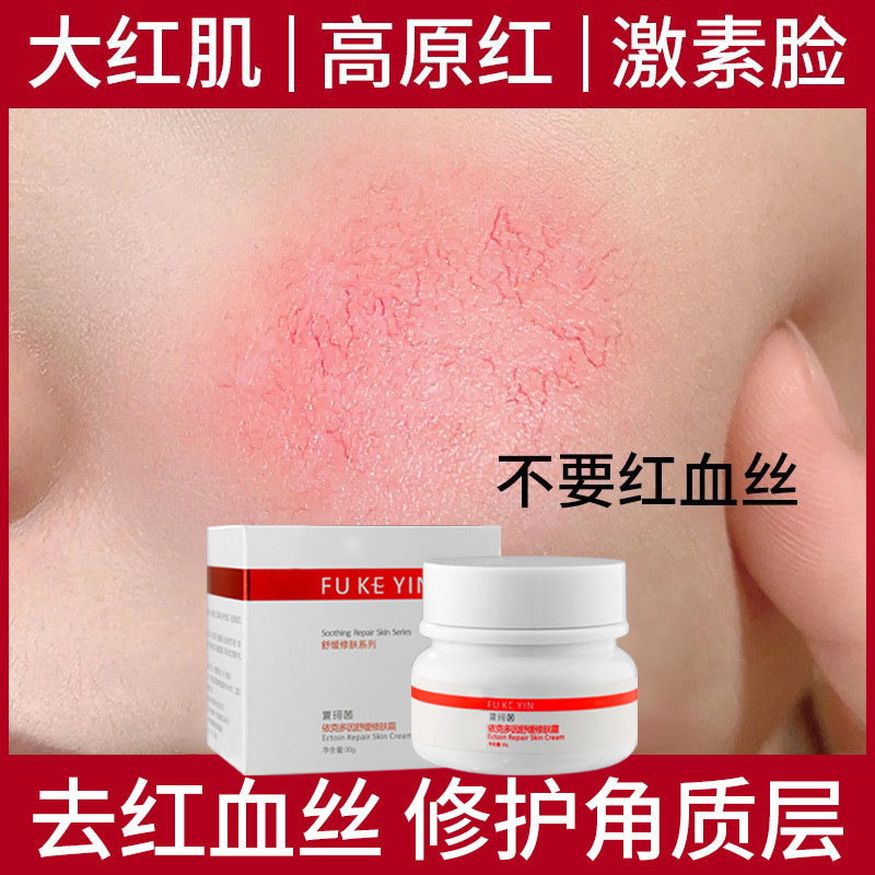 Red Blood Shatter Repair Corneal Layer Thickening Sensitive Skin Hormone Face Improvement Face Redness Soothing Repair Cream