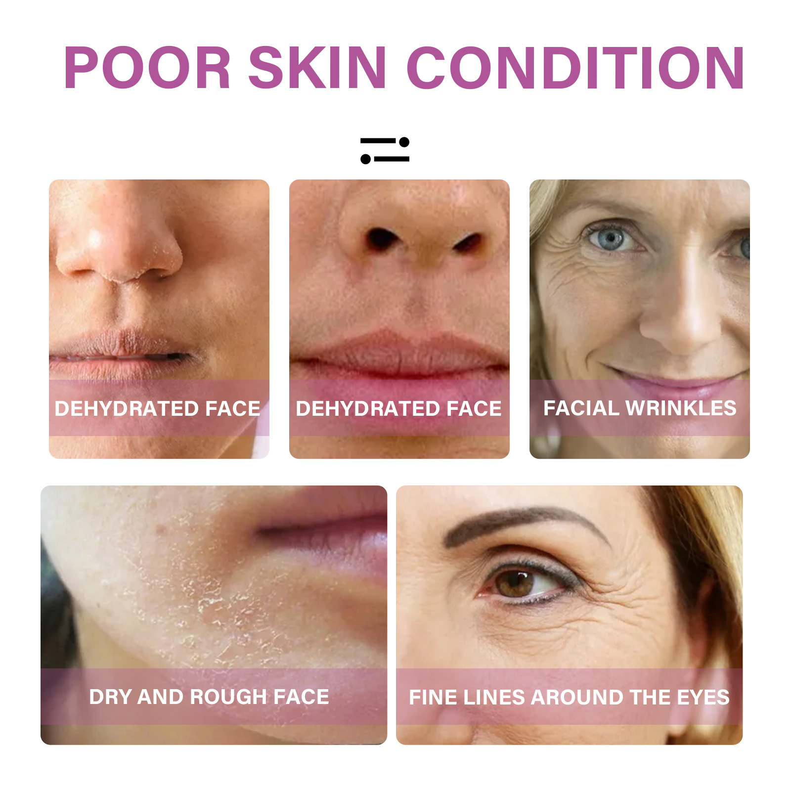 L'essenza pre-fiala di ceramide EELHOE indebolisce le linee sottili, ricostituisce l'acqua e il collagene può migliorare l'antirughe della pelle_voghion.com