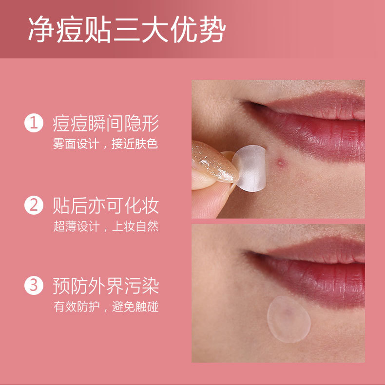 痘痘贴-详情2023-9-27_16.jpg