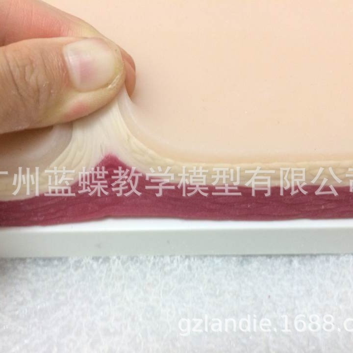 ���������ϰģ��ģ�� ���ѵ��Ƥ���轺ģ�� �轺���ģ�� ҽѧ